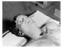 JFK Autopsy