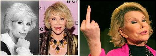 Joan Rivers multiple cosmetic surgeries