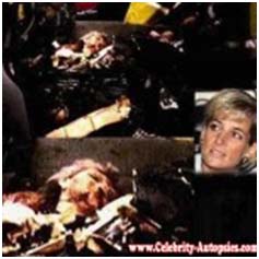 Lady Diana Dead