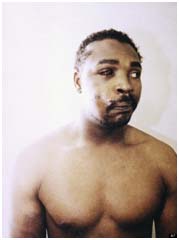 Rodney King after beating from police