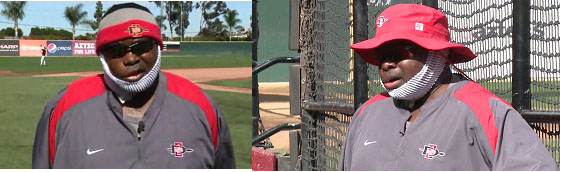 Tony Gwynn with bandages around his face